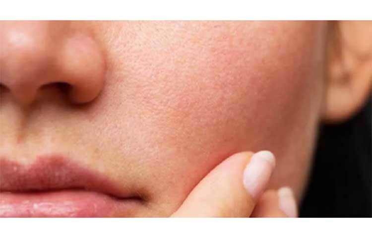 মুখে টোনার লাগানোর পর অবশ্যই নাইট ক্রিম ব্যবহার করুন।