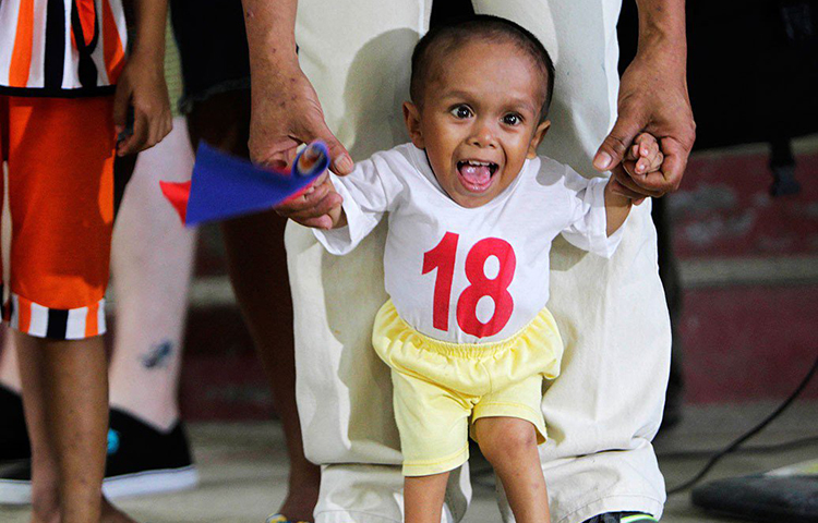 জুনরি বালাউইং: গিনেজ রেকর্ড অনুয়াযী বিশ্বের খর্বকায় ব্যক্তি জুনরি বালাউইং। উচ্চতা প্রায় ১ ফুট ১১.৬২ ইঞ্চি। ১৯৯৩ সালে ফিলিপিন্সের সিন্দানগানে এক কামারের ঘরে জন্ম জুনরির। চার ভাইবোনের মধ্যে জুনরিই বয়সে বড়। এক বছর বয়স থেকেই তার শারীরিক বৃদ্ধি থমকে যায়।