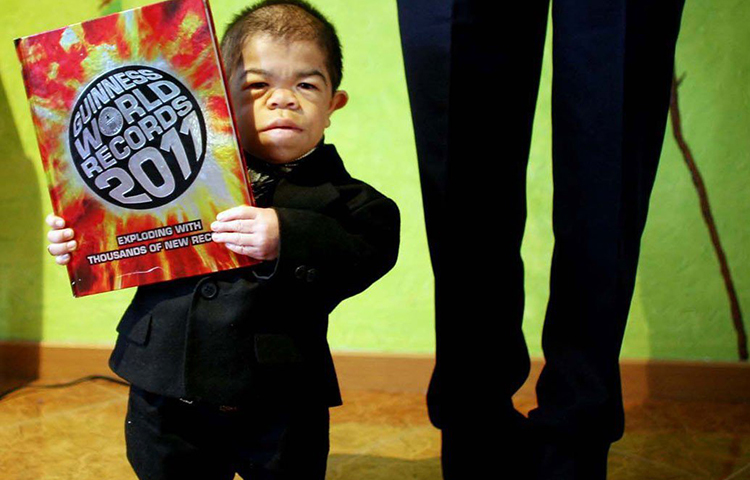 এডওয়ার্ড নিনো হার্নান্ডেজ: ২০১০ সালে বিশ্বের খর্বকায় ব্যক্তি হিসেবে গিনেস রেকর্ড করেন। ২৪ বছর বয়সে তার উচ্চতা ছিল ২ ফুট সাড়ে ৩ ইঞ্চি। ওজন ছিল ১০ কেজি। ১৯৮৬ সালে জন্ম কলম্বিয়ার বোগোটায়। নেপালের খগেন্দ্র থাপার আগে খর্বকায় পুরুষ হিসেবে রেকর্ড ছিল তার।