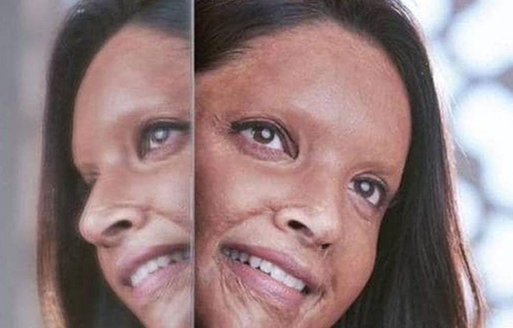 ছপক: অ্যাসিড আক্রান্ত লক্ষ্মী অগ্রবালের জীবনী নিয়ে অনুপ্রাণিত ফিল্ম ছপক। আগামী বছরের ১০ জানুয়ারি মুক্তি পাবে এই ছবি। লক্ষ্মী অগ্রবালের ভূমিকায় অভিনয় করবেন দীপিকা পাডুকোন।