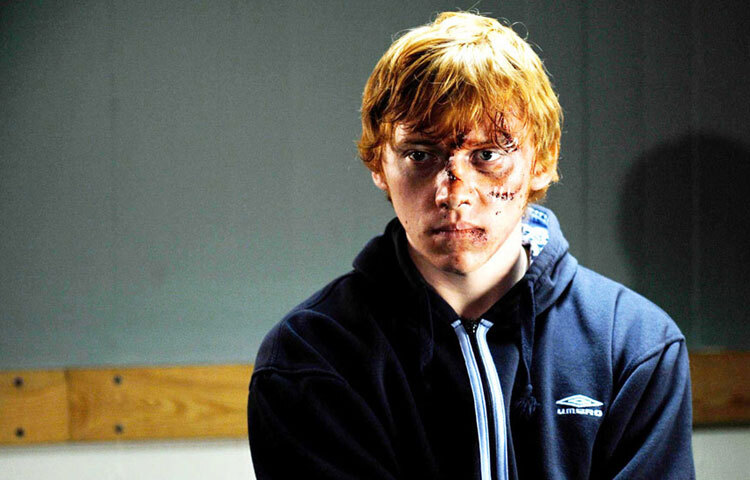 চেরিবোম্ব (২০০৯) ছবিতে তাকে দেখা যায় সম্পূর্ণ ভিন্ন রূপে। ইন্টো দ্যা হোয়াইট (২০১২) ছবিতে দ্বিতীয় বিশ্বযুদ্ধের প্রেক্ষাপটে তার অভিনয় প্রশংসিত হয়। এছাড়া তিনি সন্যাচ সিরিজে অভিনয় করেন, যেখানে তার কমেডি টাইমিং নতুনভাবে আলোচিত হয়। তবে রুপার্ট সিনেমা ছাড়াও স্টেজ ও টেলিভিশনে কাজ করেছেন, যা তার বহুমুখী প্রতিভার প্রমাণ।