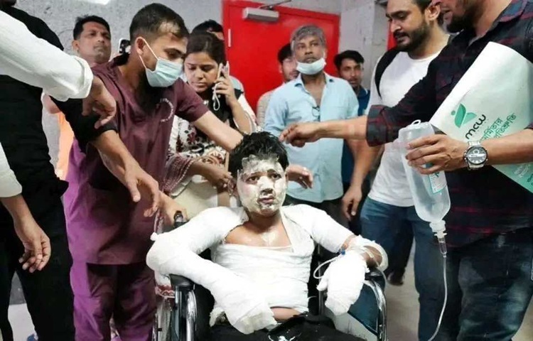 উত্তরায় মাইলস্টোন স্কুল অ্যান্ড কলেজ ক্যাম্পাসে প্রশিক্ষণ বিমান বিধ্বস্তের ঘটনায় জাতীয় বার্ন ইনস্টিটিউটে ৫১ জন ভর্তি বলে জানিয়েছেন হাসপাতালটির পরিচালক অধ্যাপক ডা. মোহাম্মদ নাসির উদ্দীন।