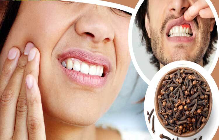 দাঁতের সমস্যা সমাধানের জন্য বেশ কার্যকরী লবঙ্গ। এতে থাকা ইউজেনল একটি প্রাকৃতিক ব্যথানাশক আর অ্যান্টিসেপটিক হিসেবে কাজ করে এটি দাঁত ও মাড়ির ব্যথা থেকে মুক্তি দেয়। এটি মুখের ক্ষতিকারক ব্যাকটেরিয়াগুলোর বিরুদ্ধে লড়াইয়ের পাশাপাশি সতেজ নিশ্বাস ও মুখগহ্বরের স্বাস্থ্যরক্ষার কাজ করে। ছবি: জাগো নিউজ