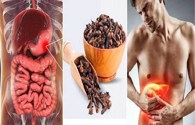 লবঙ্গ পেটের গ্যাস, ফাঁপা ভাব আর বদহজম কমিয়ে হজমে সাহায্য করতে পারে। এটি পাচক এনজাইমগুলোর নিঃসরণকে উদ্দীপিত করতে এবং পুষ্টির শোষণ বাড়াতে সক্ষম। ছবি: জাগো নিউজ