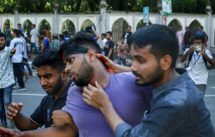 ছাত্রলীগের হামলায় আহত হয়েছেন অনেক শিক্ষার্থী। ছবি: মাহবুব আলম