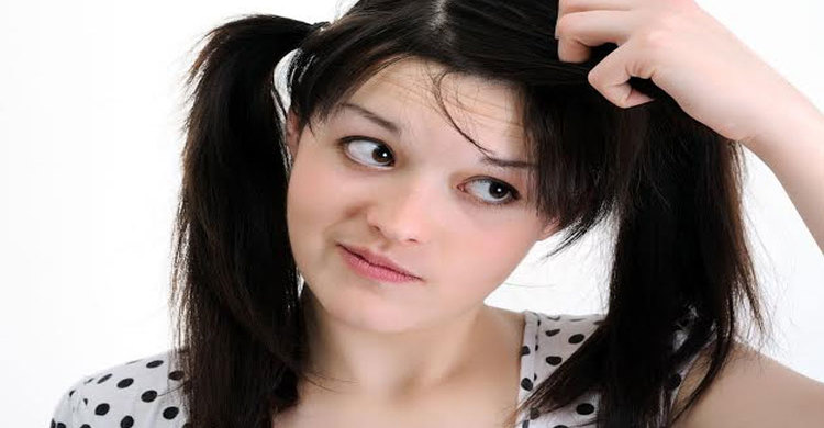 খুশকি দূর করতে