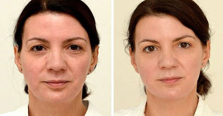 শুধু পানি খেয়েই একমাসে সুন্দরী