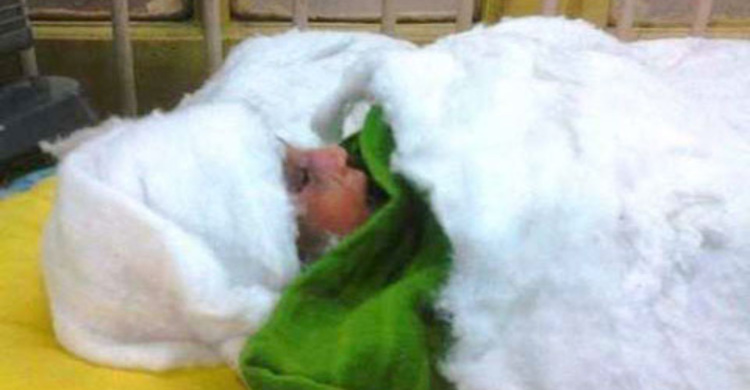 Baby shot in womb sent to ICU