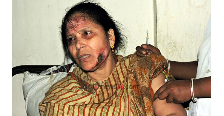 মাগুরা জজকোর্টের নারী পিয়নকে এসিড নিক্ষেপ, আটক ৩