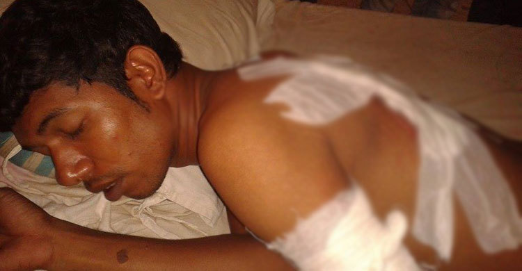 গ্রামীণ ফোনের কর্মীকে কুপিয়ে টাকা ছিনতাই