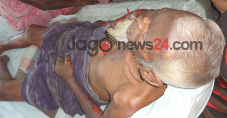 খোকসায় গরু বাঁচাতে গিয়ে দগ্ধ হলেন বৃদ্ধ 