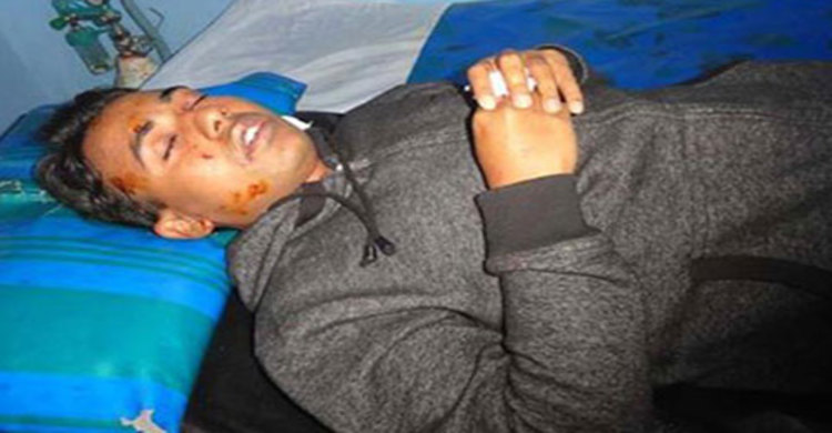 ফেনীতে বোমা হামলায় এনডিসি ও ২ ম্যাজিস্ট্রেট আহত 