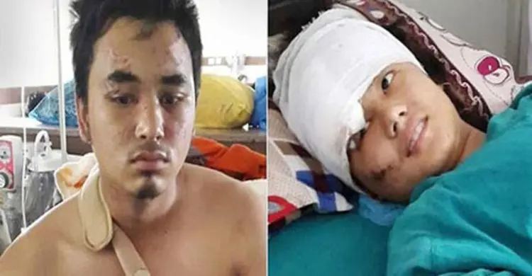 ২০০ ফুট উপর থেকে পড়েও বেঁচে আছেন যে যুগল