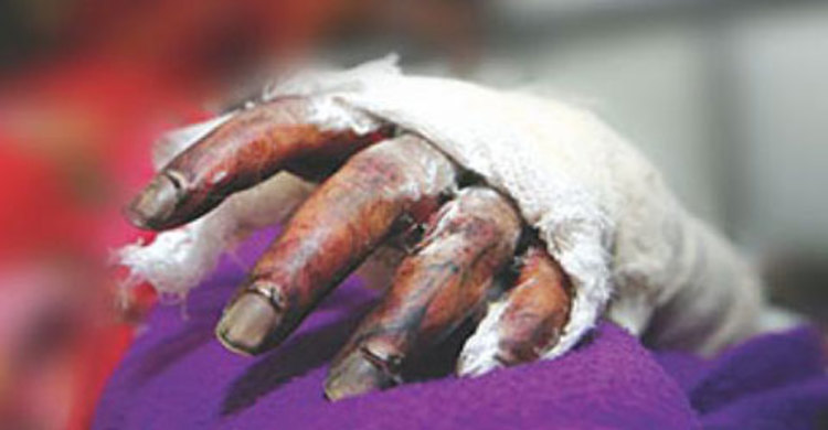 করিমগঞ্জে ১৩ দিন পর অগ্নিদগ্ধ গৃহবধূর মৃত্যু