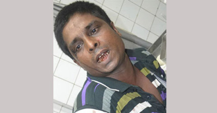 উত্যক্তের প্রতিবাদ করায় বাবাকে গাছে বেঁধে নির্যাতন