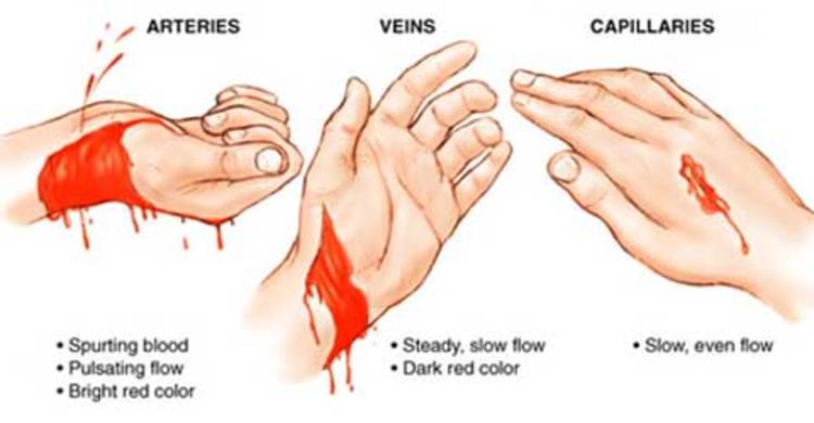 রক্তক্ষরণ বন্ধ করতে করণীয়