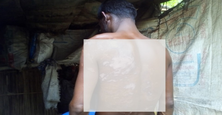 হামাগেরে মতো গরীবের মরেই যাওয়াই ভালো!