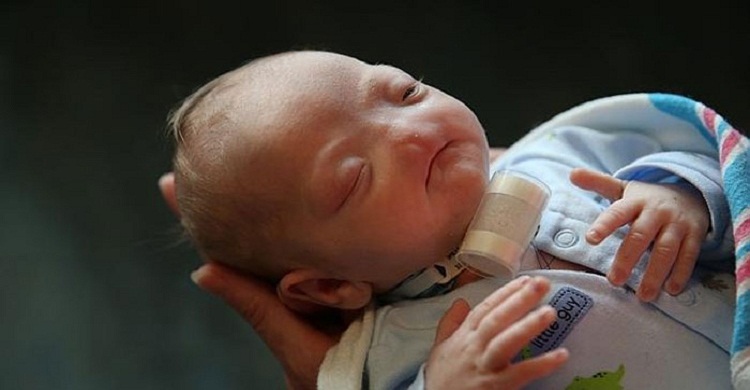 অবাক করা শিশু এলি!