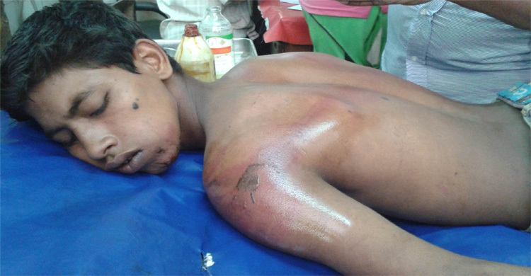 চশমা চুরির অভিযোগে এতিম শিশুকে নির্মম নির্যাতন