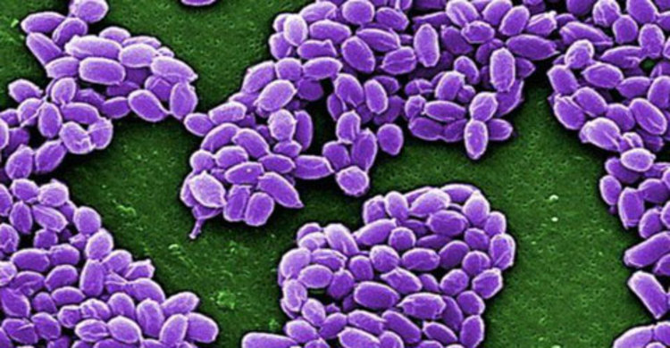 অ্যানথ্রাক্সের জীবন্ত নমুনা গবেষণাগারে!