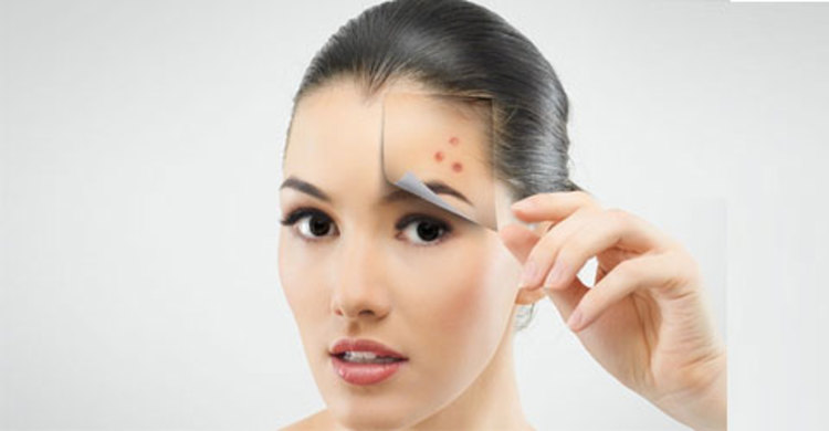 পক্সের দাগ দূর করার উপায়