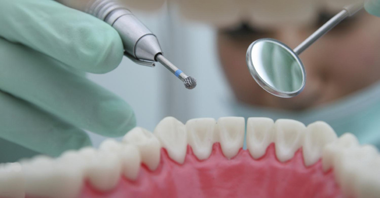 Tooth decay can be reversed without drilling and filling