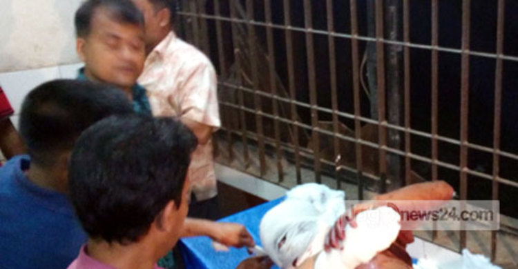 বোমা বানাতে গিয়েই ৩ যুবক আহত : পুলিশ