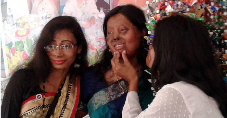 রাজধানীতে এসিড সারভাইভারদের ব্যতিক্রমধর্মী মেলা