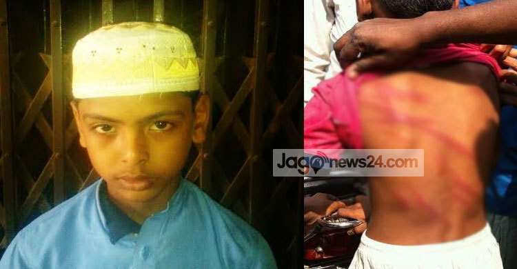 শিক্ষকের বেত্রাঘাতে মাদরাসাছাত্র আহত