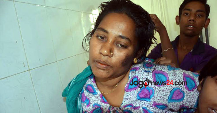 ছাড়া পেয়েই গৃহবধূর চুল কেটে নিলো ইভটিজিং মামলার আসামিরা