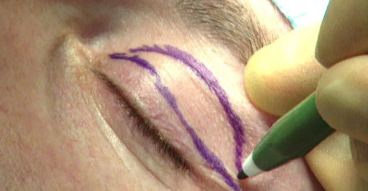 বিট্রিশ পুরুষদেরও আগ্রহ বাড়ছে কসমেটিক সার্জারিতে