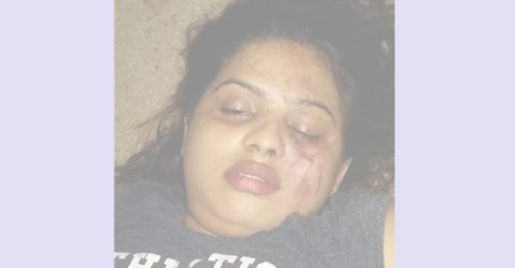 হোটেলে নিহত তরুণীর মরদেহ নিয়ে গেলেন পিতা