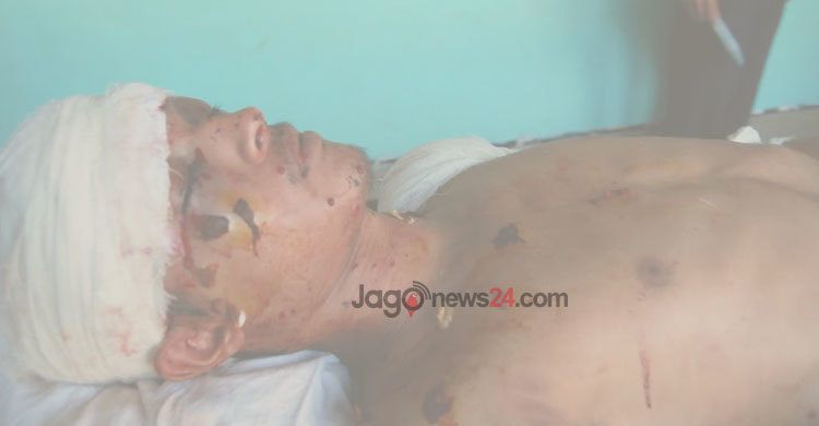 এমসি কলেজে সংঘর্ষে আহত ছাত্রলীগকর্মীকে ঢাকায় প্রেরণ