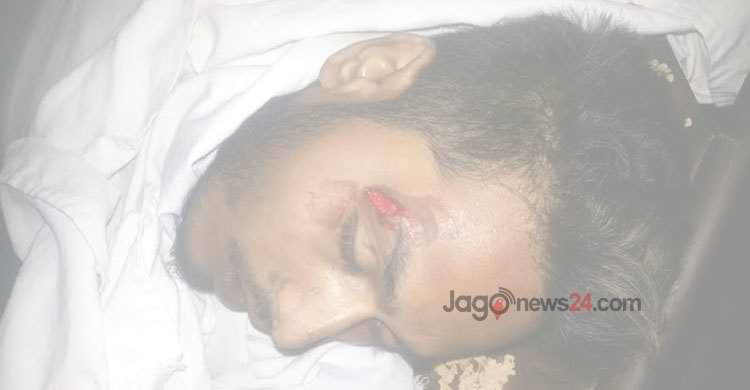 সিলেটে দুলাভাইয়ের হাতে শ্যালক খুন