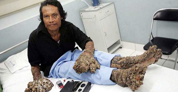 চলে গেলেন বৃক্ষমানব ডেডে কসওয়ারা