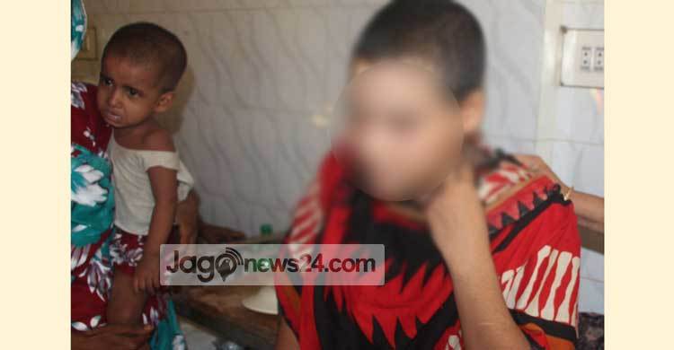 পালিত সন্তান হওয়ায় চুল কেটে দিল শাশুড়ি