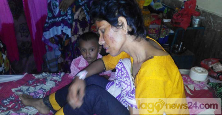 যৌতুক না পেয়ে স্ত্রীর চুল কেটে নিল পুলিশ 