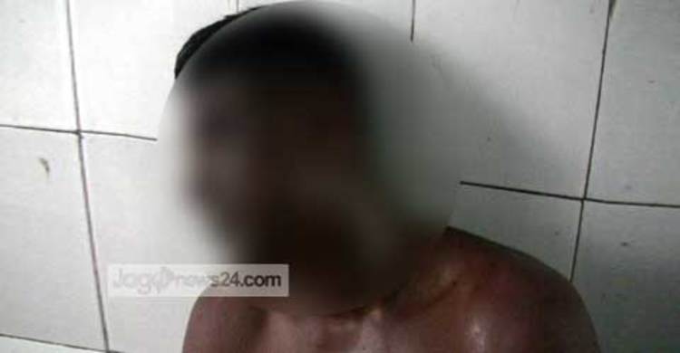 মাগুরায় ভাইরার ছোড়া এসিডে দগ্ধ অপর ভাইরা