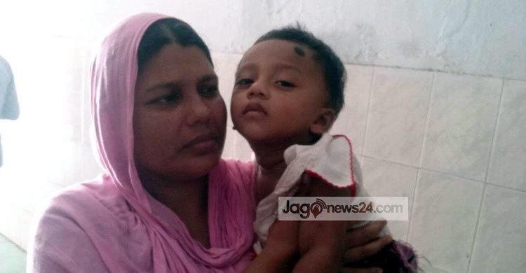 শরীয়তপুরে ভিমরুলের কামড়ে মা-ছেলে আহত