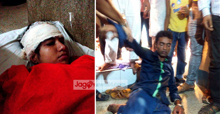 জামালপুরে কলেজছাত্রীকে কুপিয়ে জখম : আটক ১