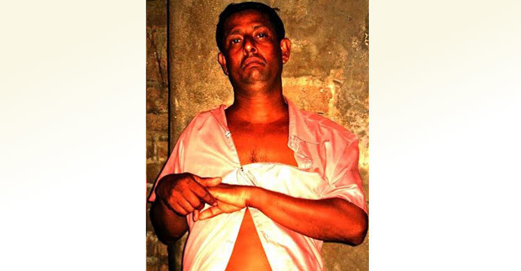 থানায় অভিযোগ দেয়ায় হাত ভেঙে দিলেন চেয়ারম্যান