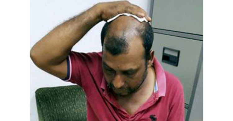 বিমানবন্দর ম্যাজিস্ট্রেটের গাড়িতে হামলা