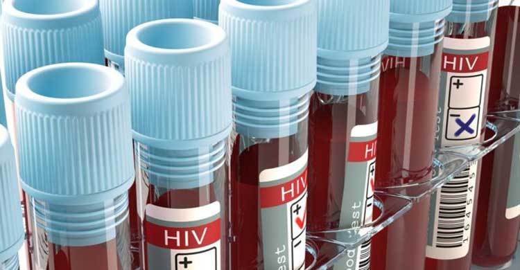 ‘HIV effort let down by test shortages’