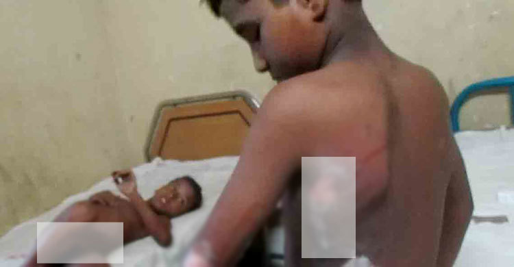 ওয়ার্কশপের আগুনে তিন শিশু শ্রমিক দগ্ধ 