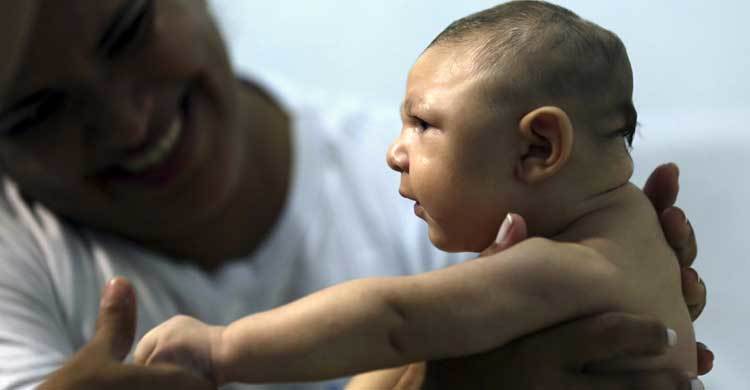 Spain registers first Zika microcephaly birth