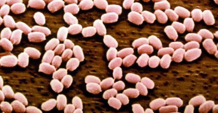 Russia anthrax outbreak affects dozens in north Siberia 