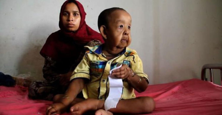 BD boy with ‘old man’ illness baffles doctors 