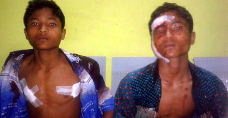 কুড়িয়ে পাওয়া বোমা বিস্ফোরণে ৪ কিশোর আহত 