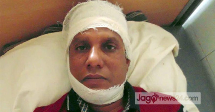সংবাদ প্রকাশ করায় সাংবাদিককে হাতুড়িপেটা