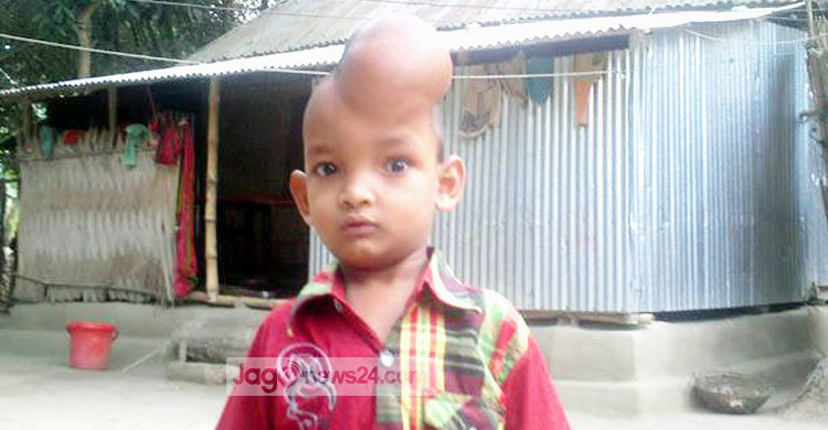 জাগো নিউজের আরেক মিশন শিশু ইব্রাহিম